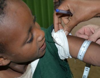 Measuring Vulnerable Kids in the Fight Against Malnutrition